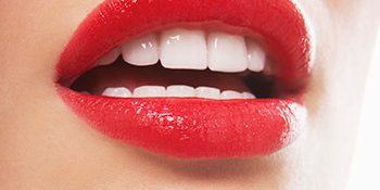What Is Tooth Whitening What Is Tooth Whitening