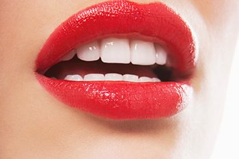 What Is Tooth Whitening What Is Tooth Whitening