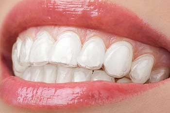 bright white teeth in sutton bright white teeth in sutton