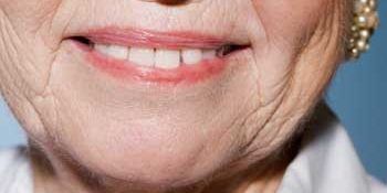 difference between nhs and private dentistry sutton