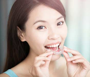 Looking For A Discreet Orthodontic Alternative To Braces?