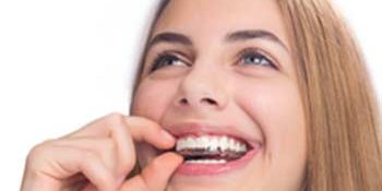 Looking For A Discreet Orthodontic Alternative To Braces Looking For A Discreet Orthodontic Alternative To Braces