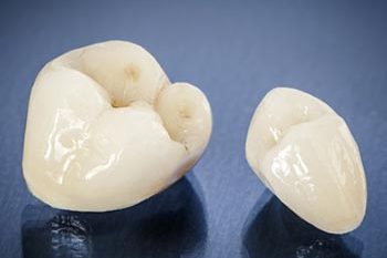 faqs about crowns carshalton sutton