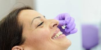 faqs about veneers carshalton sutton faqs about veneers carshalton sutton