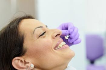 faqs about veneers carshalton sutton faqs about veneers carshalton sutton