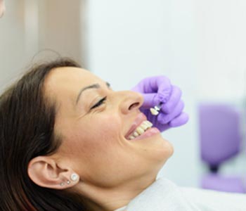 faqs about veneers carshalton sutton faqs about veneers carshalton sutton