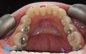 ba case 14 before 1