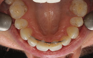 ba case 4 after