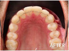 orthodontics after1