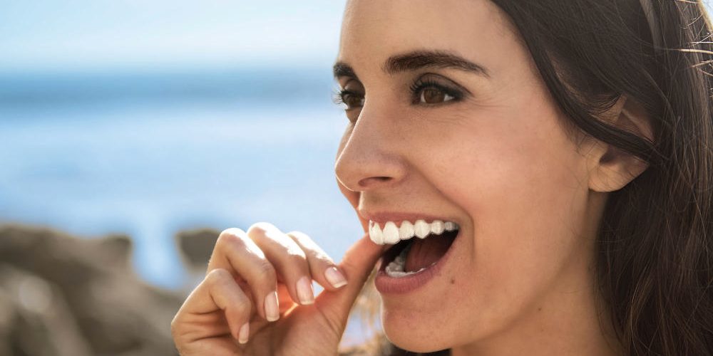 invisalign invisalign