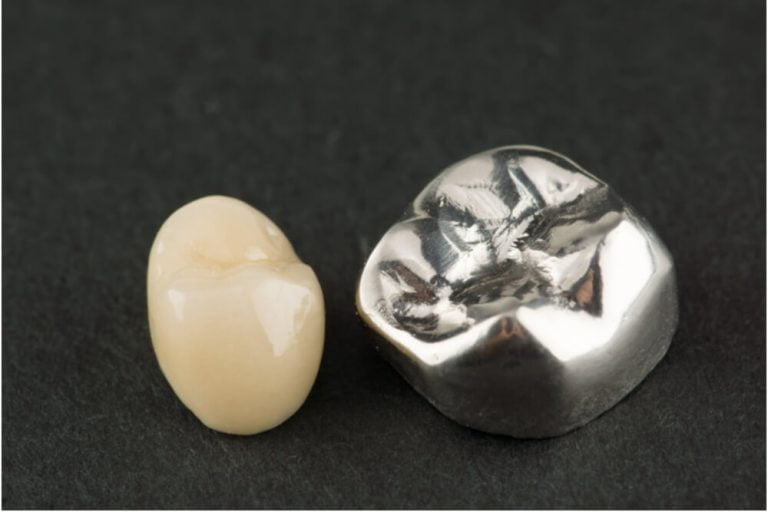 types of dental crown types of dental crown