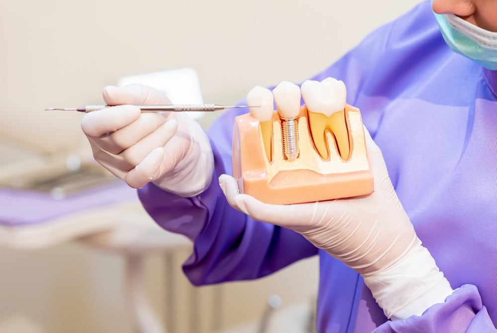 Types of false teeth Sensational Smiles