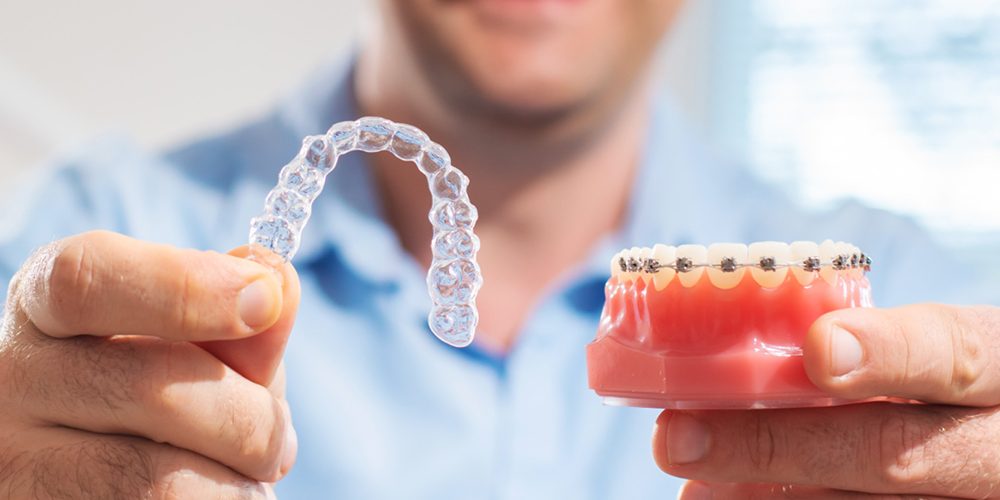 How to straighten teeth