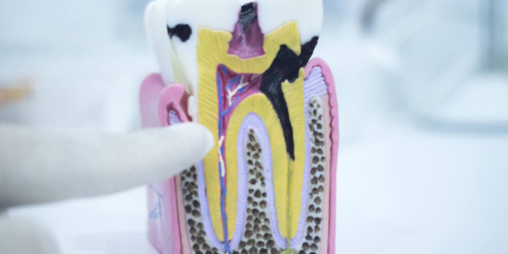 Tooth enamel Tooth enamel