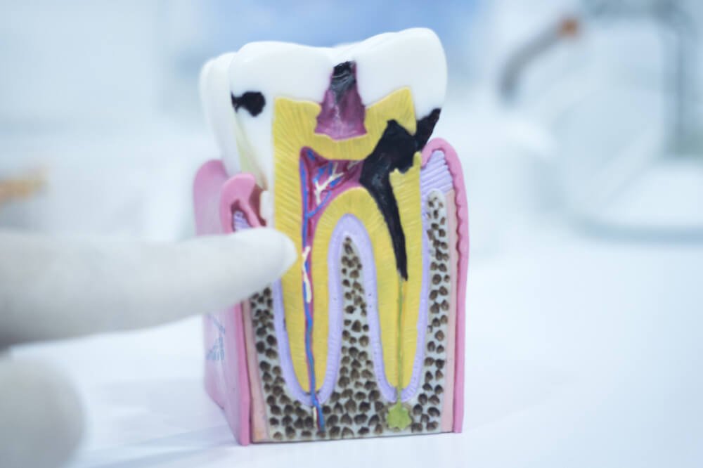 How To Strengthen Your Tooth Enamel Sensational Smiles