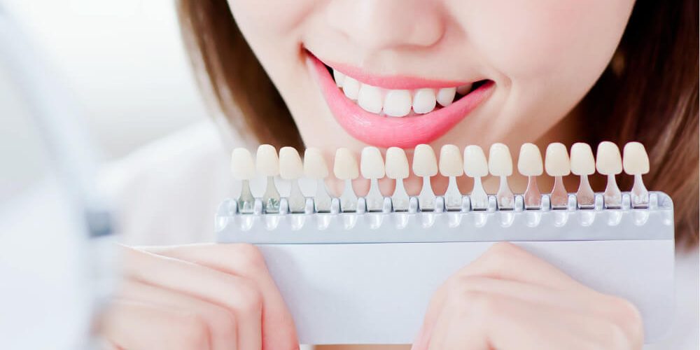 types of teeth stains types of teeth stains