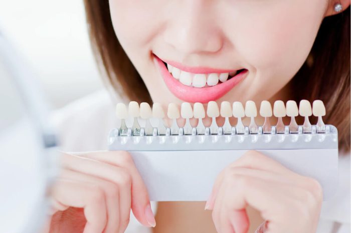 types of teeth stains types of teeth stains