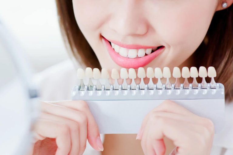 types of teeth stains types of teeth stains