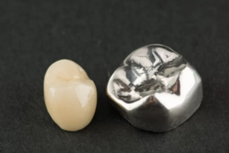 Type of Dental Crowns Type of Dental Crowns