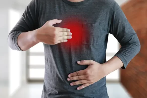 What Causes Acid Reflux What Causes Acid Reflux